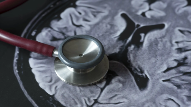 charla sobre acv en pami la plata: claves para prevenir y actuar a tiempo