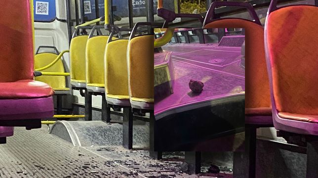 viajaba en un micro en la plata, le tiraron un piedrazo y le rompieron todos los dientes