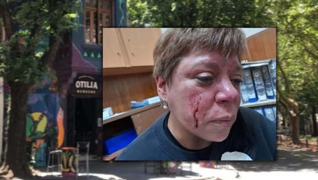 Agredida en Otilia.jpg