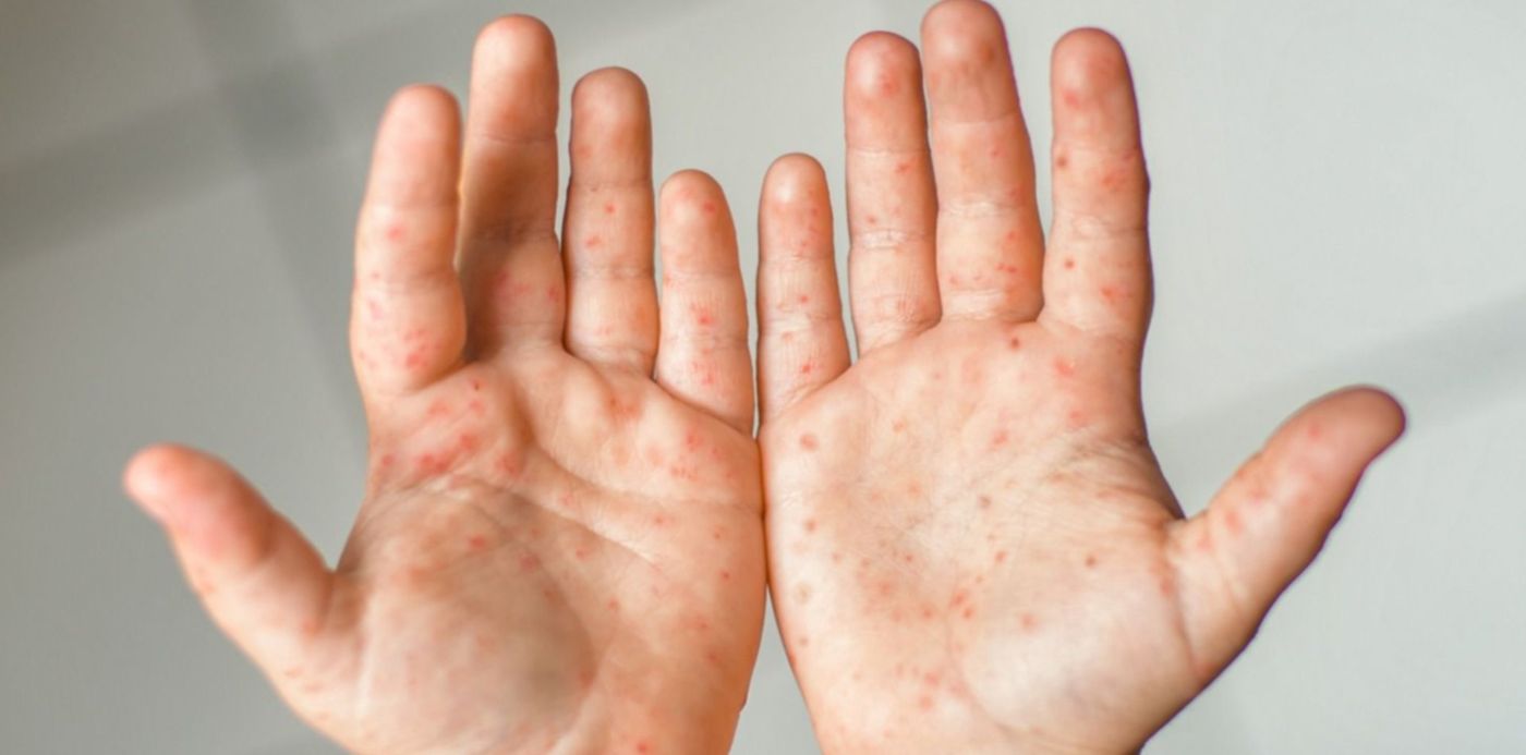 1649801625338.jpeg?x=13&y=5&width=1475&height=738&rotate=0&scaleX=1&scaleY=1&ow=1500&oh=750&&cw=1920&ch=950