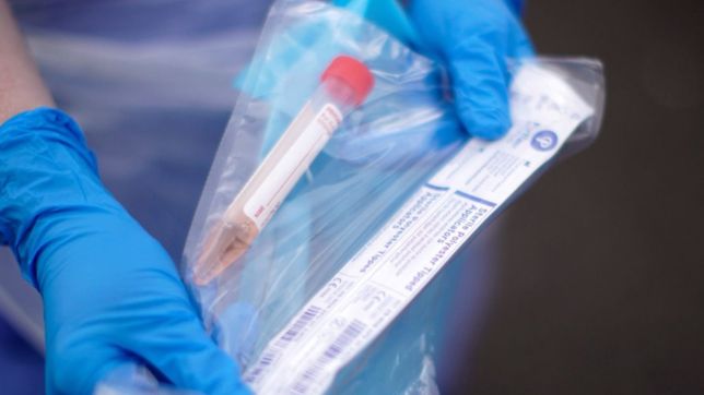 detectan el primer caso de la subvariante sigilosa de la cepa omicron en argentina