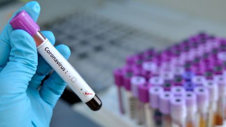 Confirman la cuarta muerte por coronavirus en Argentina: fue en Provincia de Buenos Aires