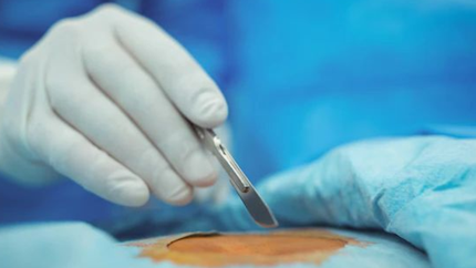 Insólita mala praxis: le diagnosticaron cáncer un riñón, pero le sacaron el otro por error