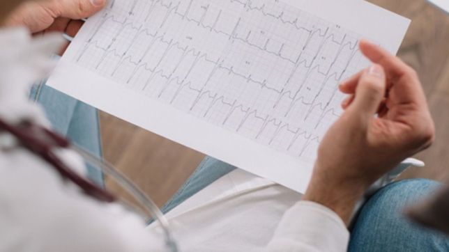 la infeccion por covid-19 aumenta el riesgo cardiaco hasta un ano despues del alta