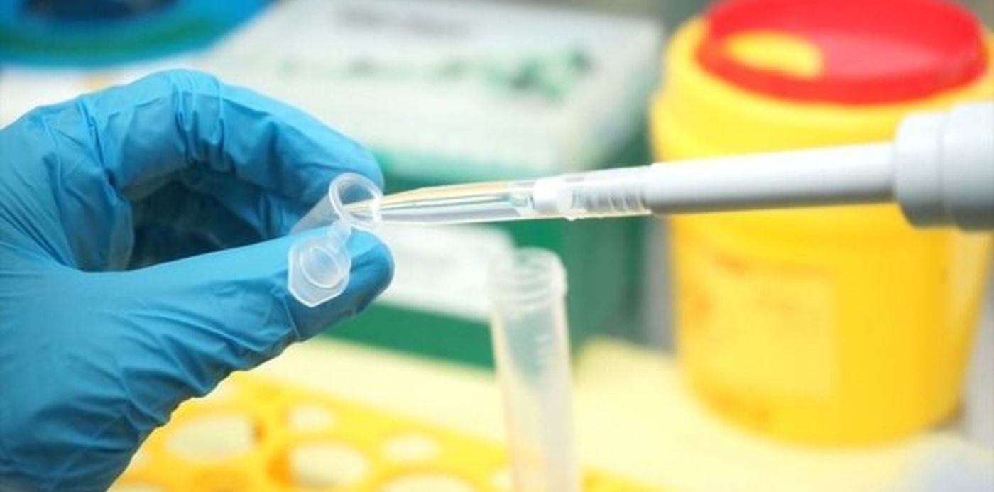 1598293090645.jpg?x=0&y=9&width=640&height=320&rotate=0&scaleX=1&scaleY=1&ow=640&oh=360&&cw=1920&ch=950