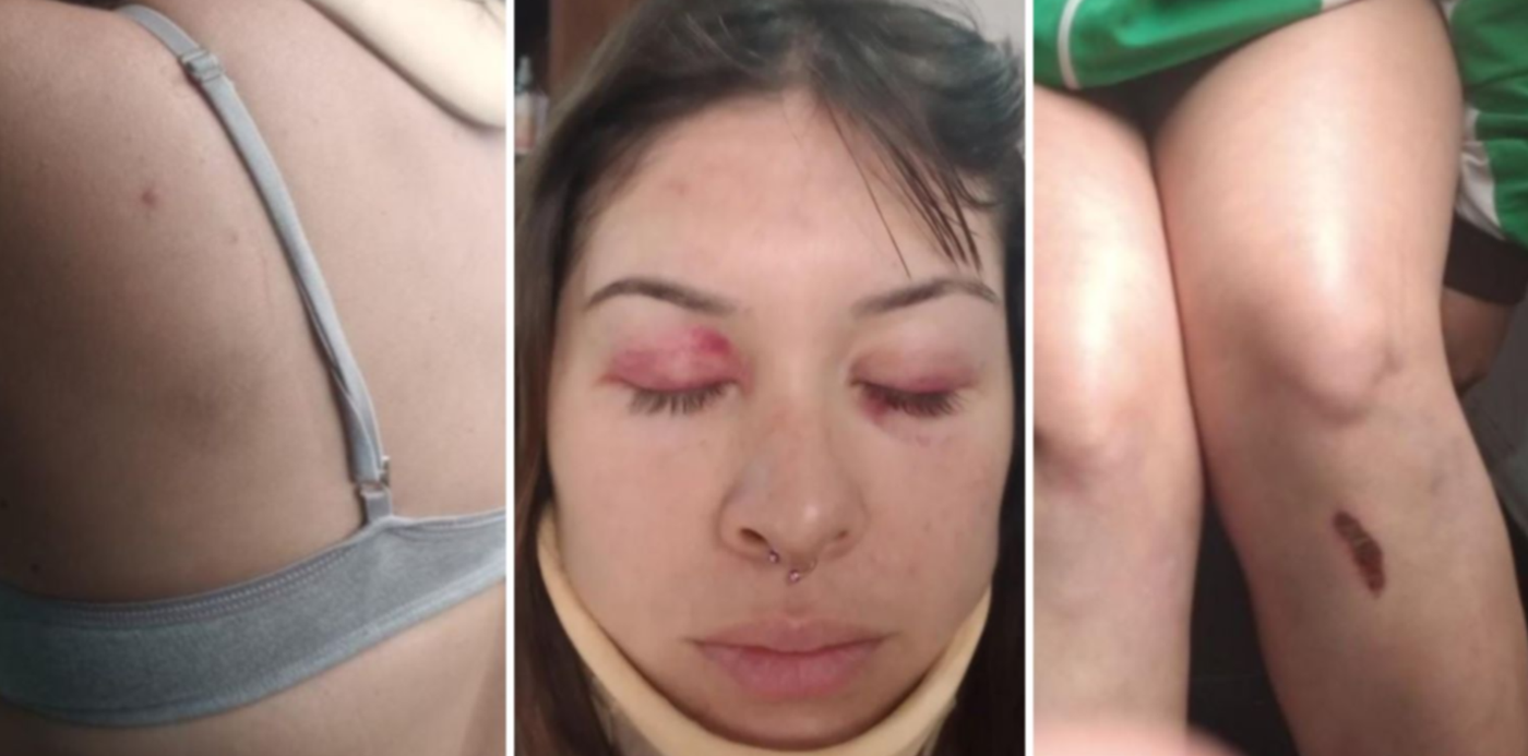 Chica golpeada en Hogans