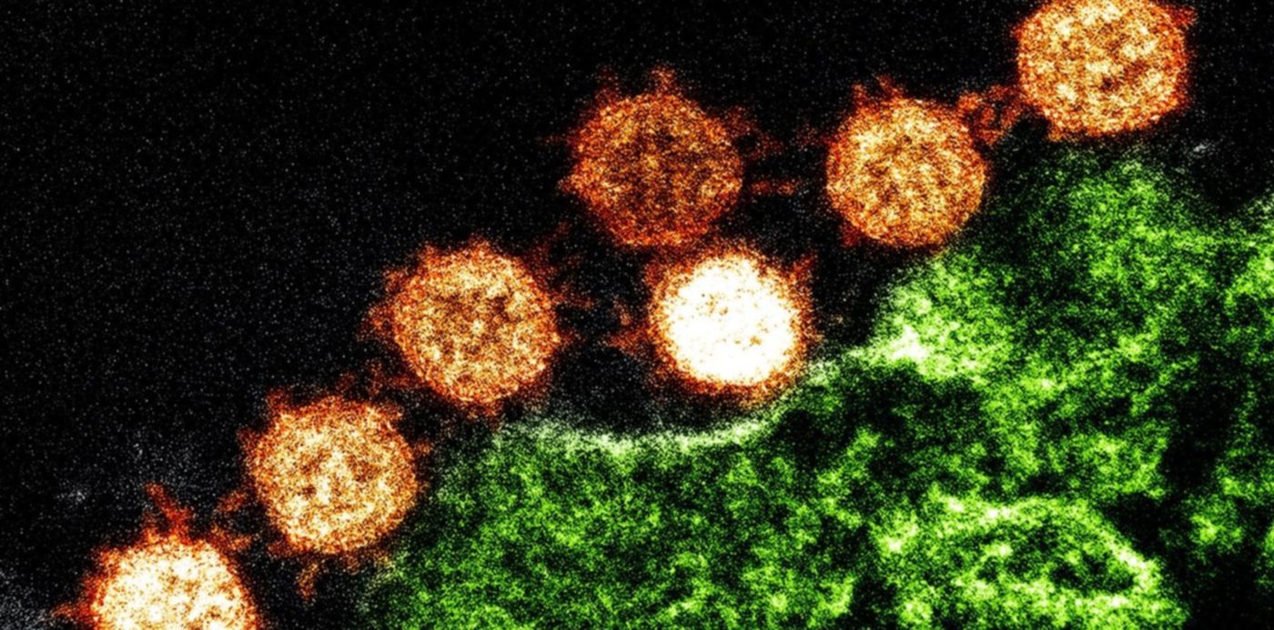 1580068416397.jpg?height=747&rotate=0&scaleY=1&x=3&y=86&width=1493&scaleX=1&ow=1500&oh=999&&cw=1920&ch=950