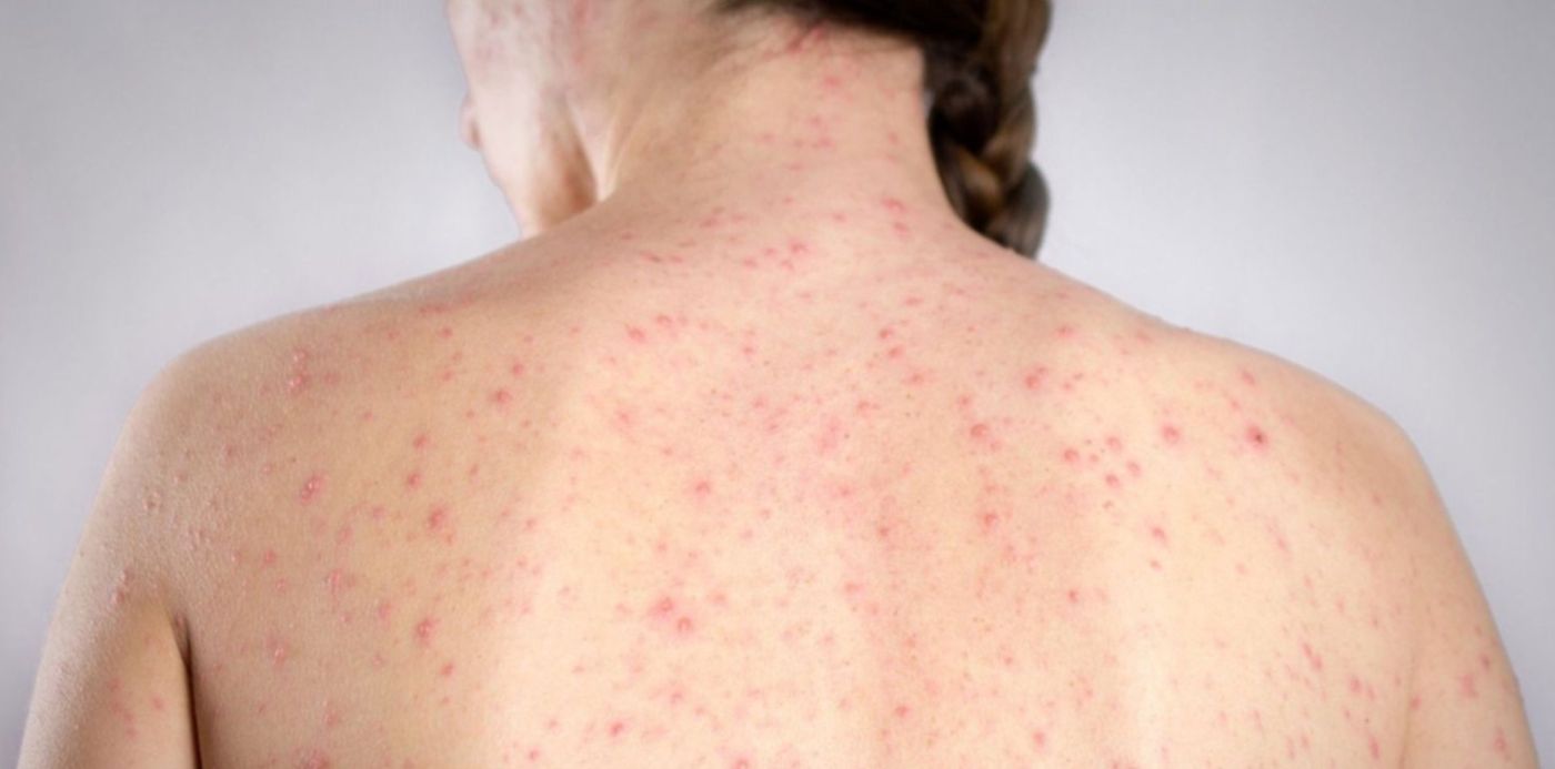 1648504902378.jpg?x=7&y=9&width=1486&height=743&rotate=0&scaleX=1&scaleY=1&ow=1500&oh=843&&cw=1920&ch=950