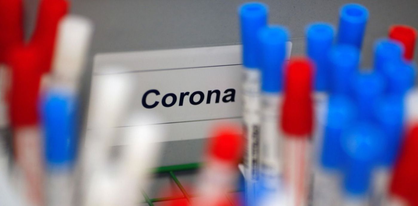 1585424739927.jpg?x=7&y=0&height=743&rotate=0&oh=1000&width=1487&scaleX=1&scaleY=1&ow=1500&&cw=1920&ch=950