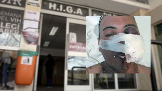 ojo en riesgo y fracturas: hablo el unico internado tras la represion