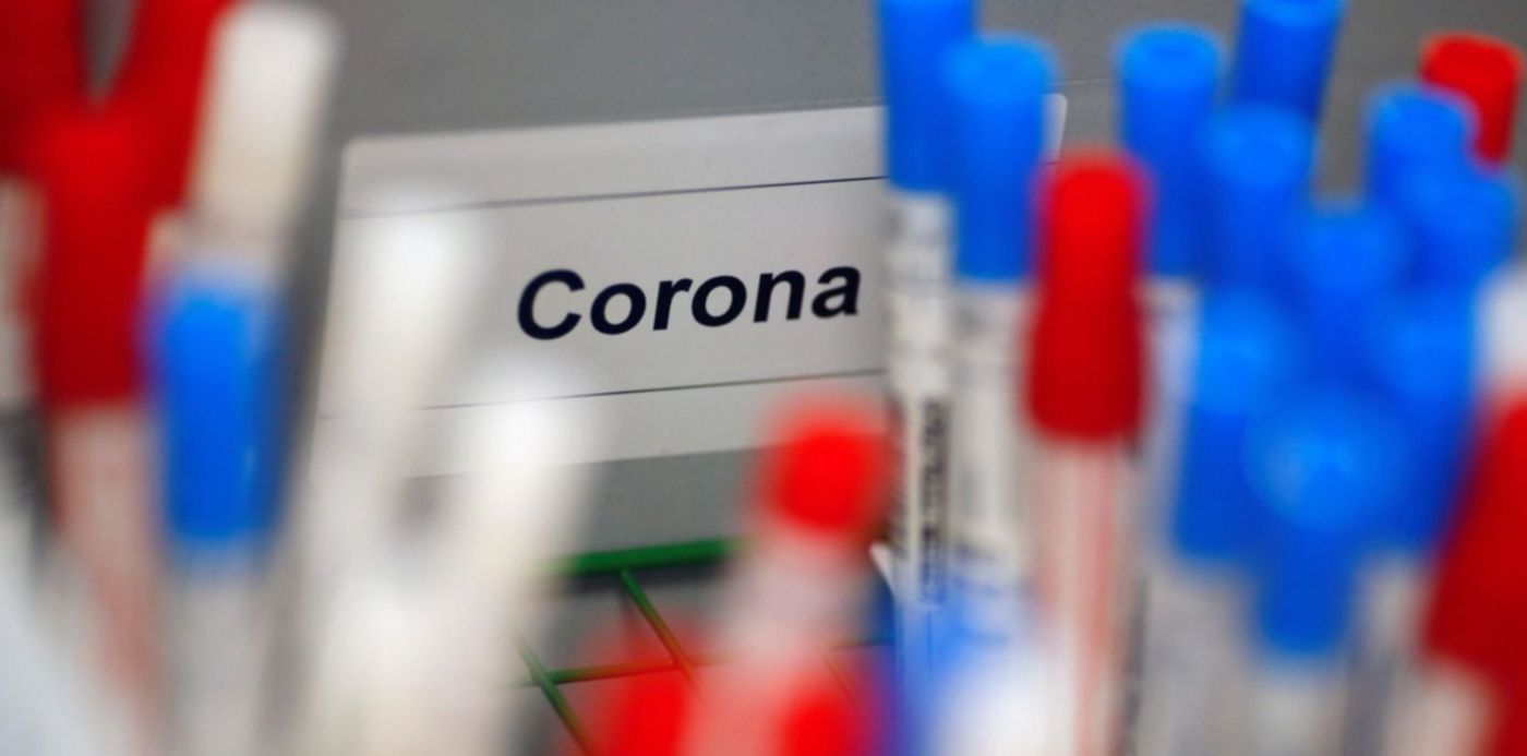 1585424739927.jpg?oh=1000&x=7&width=1487&rotate=0&scaleX=1&y=57&height=743&scaleY=1&ow=1500&&cw=1920&ch=950