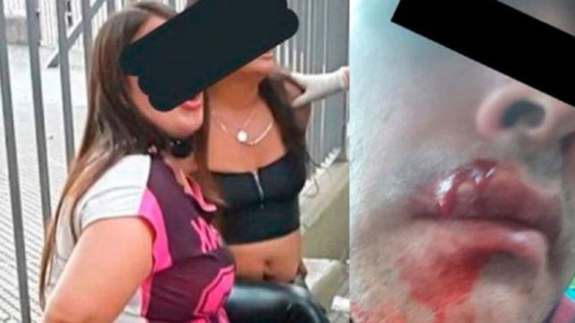 mujeres atacaron a piedrazos a un policia que les pidio que se pusieran el barbijo