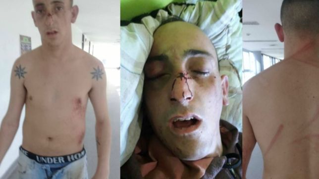 brutal golpiza en almendra: un joven fue atacado por patovicas y termino en el hospital
