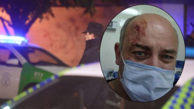 cayo el negro roque?, acusado de balear en la cabeza a un vecino de la plata para robarle