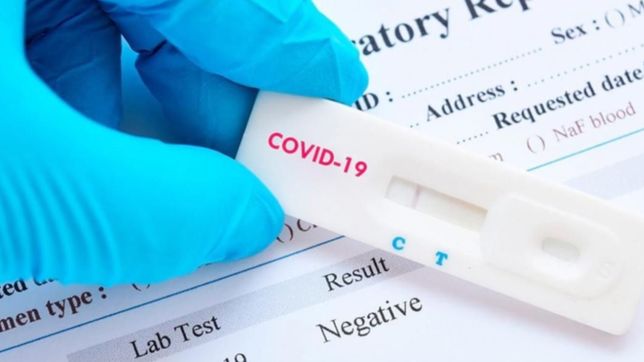 ¿por que el test rapido de covid que creo la unlp no se podra comprar en las farmacias?