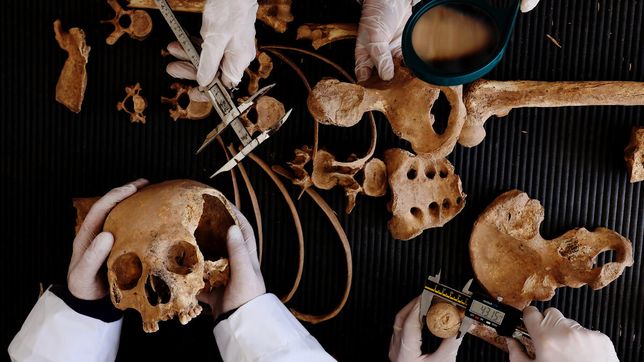 expertos de la unlp hicieron un hallazgo clave sobre la artrosis tras estudiar restos humanos