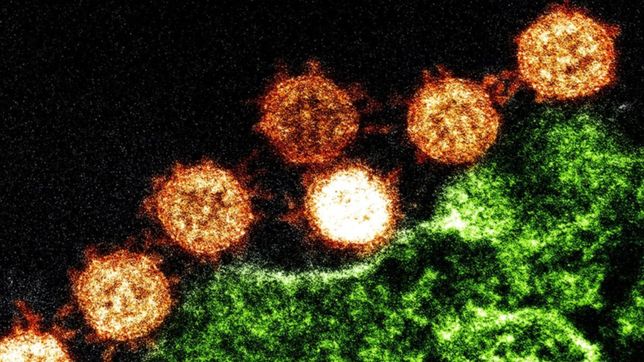 e484k, la mutacion del coronavirus que genera dudas sobre la eficacia de las vacunas
