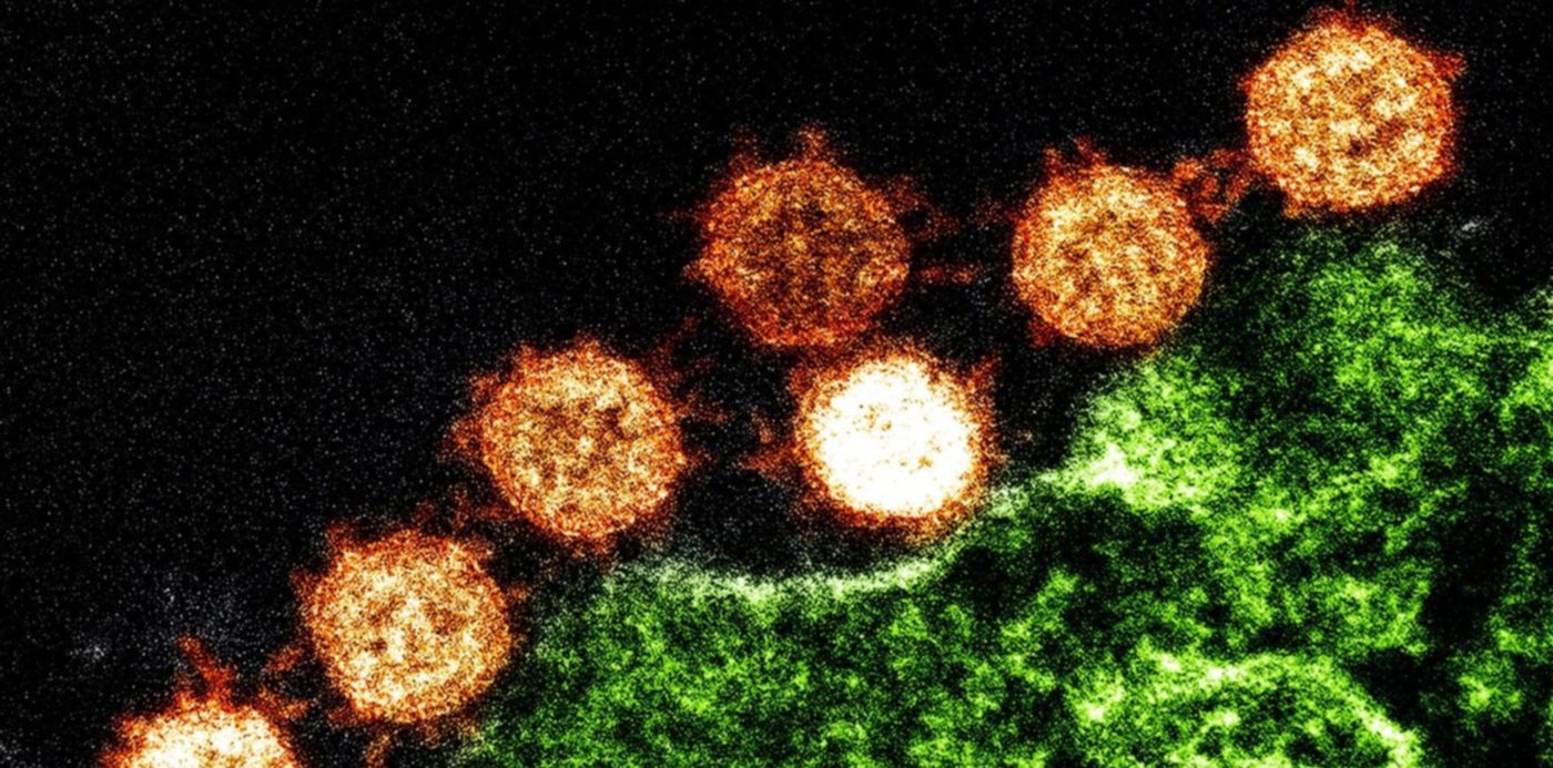 1580068416397.jpg?x=3&y=43&width=1486&height=743&rotate=0&scaleX=1&scaleY=1&ow=1500&oh=999&&cw=1920&ch=950