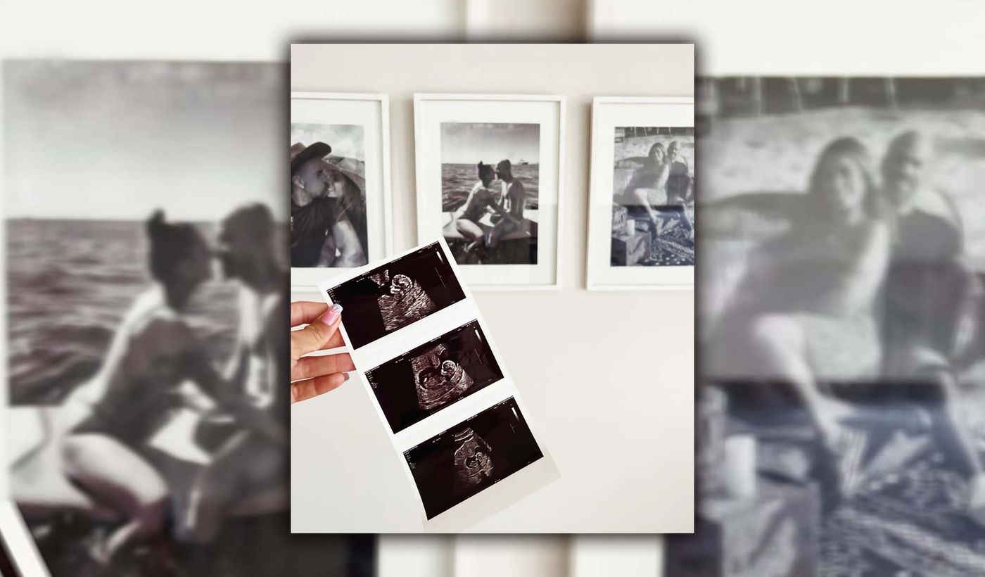 Ecografia de la hija de Verón.jpg