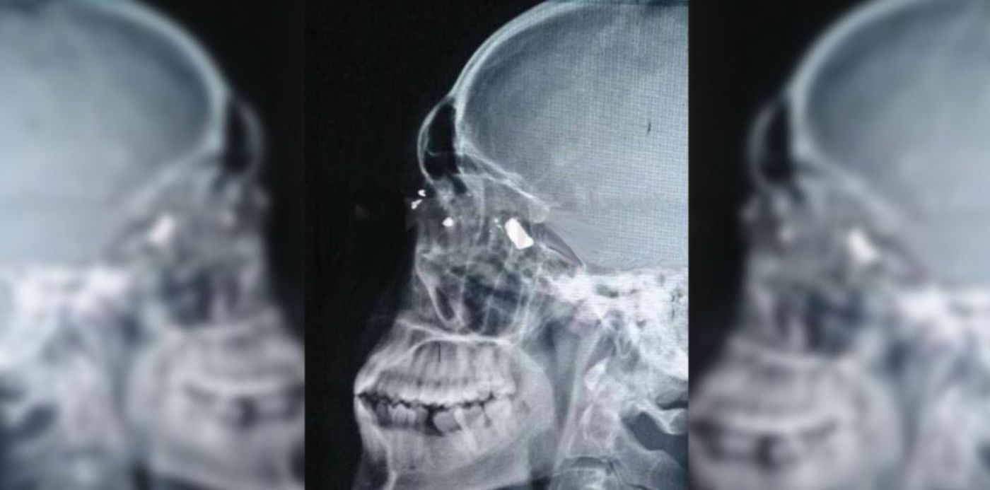 1566933444017.jpg?scaleX=1&scaleY=1&oh=742&x=8&y=0&width=1484&height=742&rotate=0&ow=1500&&cw=1920&ch=950