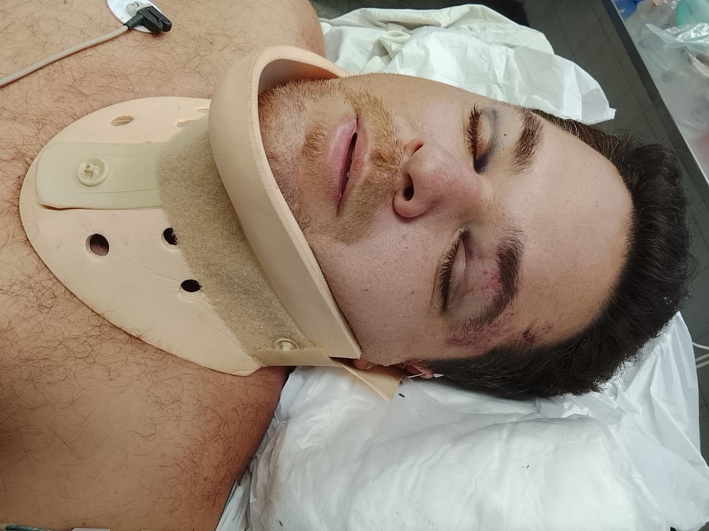 El hombre fue atacado por motochorros mientras iba a su casa en La Plata