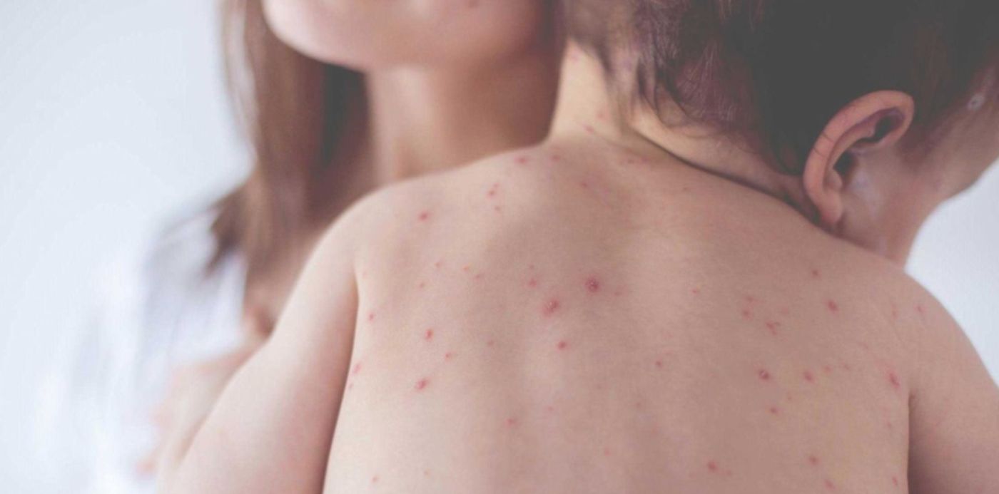 1648676484966.jpg?x=8&y=11&width=1485&height=743&rotate=0&scaleX=1&scaleY=1&ow=1500&oh=1125&&cw=1920&ch=950