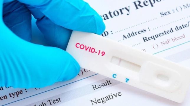 ¿cuanto costara el test rapido de coronavirus desarrollado en la unlp?