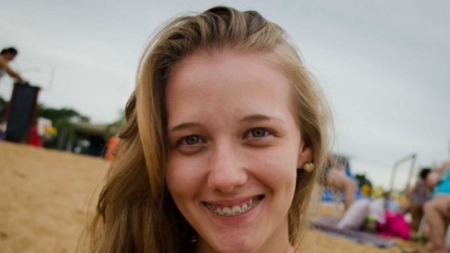 ¿usas brackets? tres consejos para saber como cuidarlos