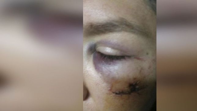 golpes y sana a la salida de un bar: el relato en primera persona de una de las victimas