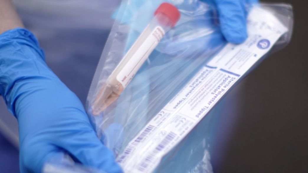 Dos hospitales, el Bioquímico y la UNLP se suman a la realización de test de coronavirus en La Plata