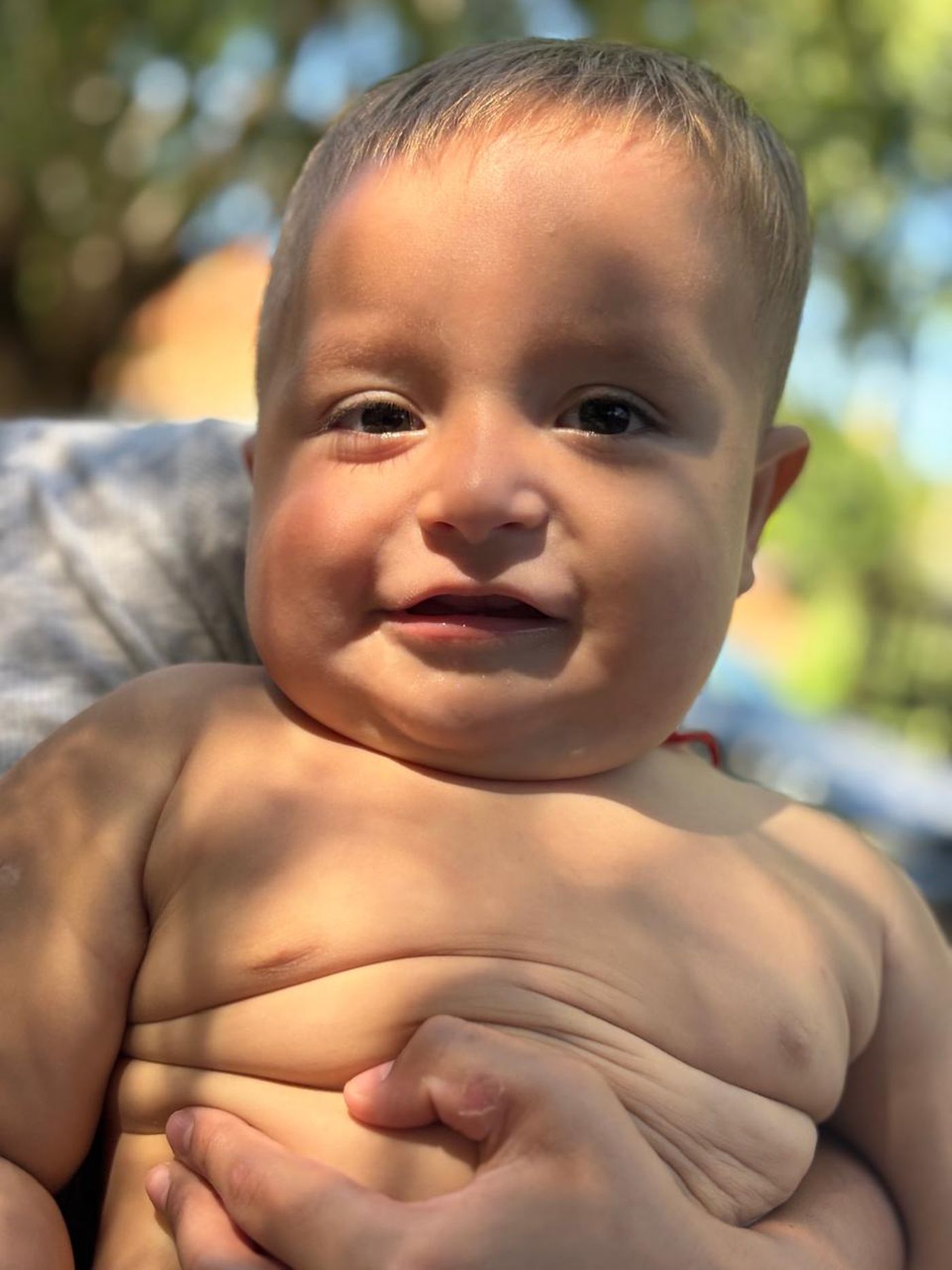 Emilio, el bebé que necesita el casco especial.jpeg