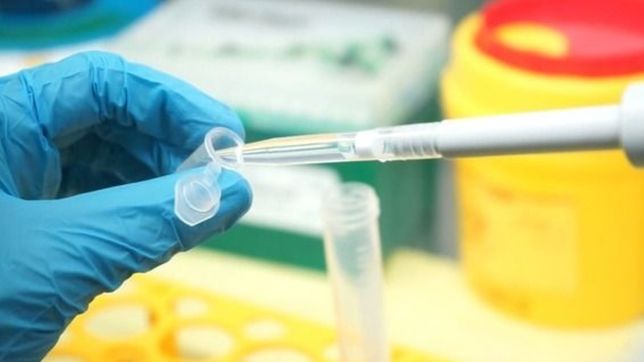 la unlp ya realizo mas de 20.000 testeos para diagnosticar casos de coronavirus