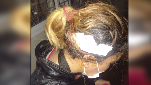 peluquera resistio un robo en la plata, forcejeo con el ladron y resulto herida