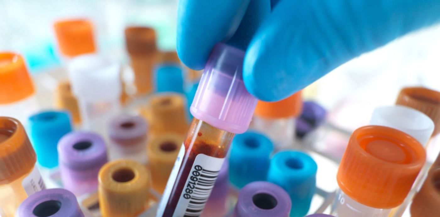 1587522143388.jpg?&cw=1920&ch=950