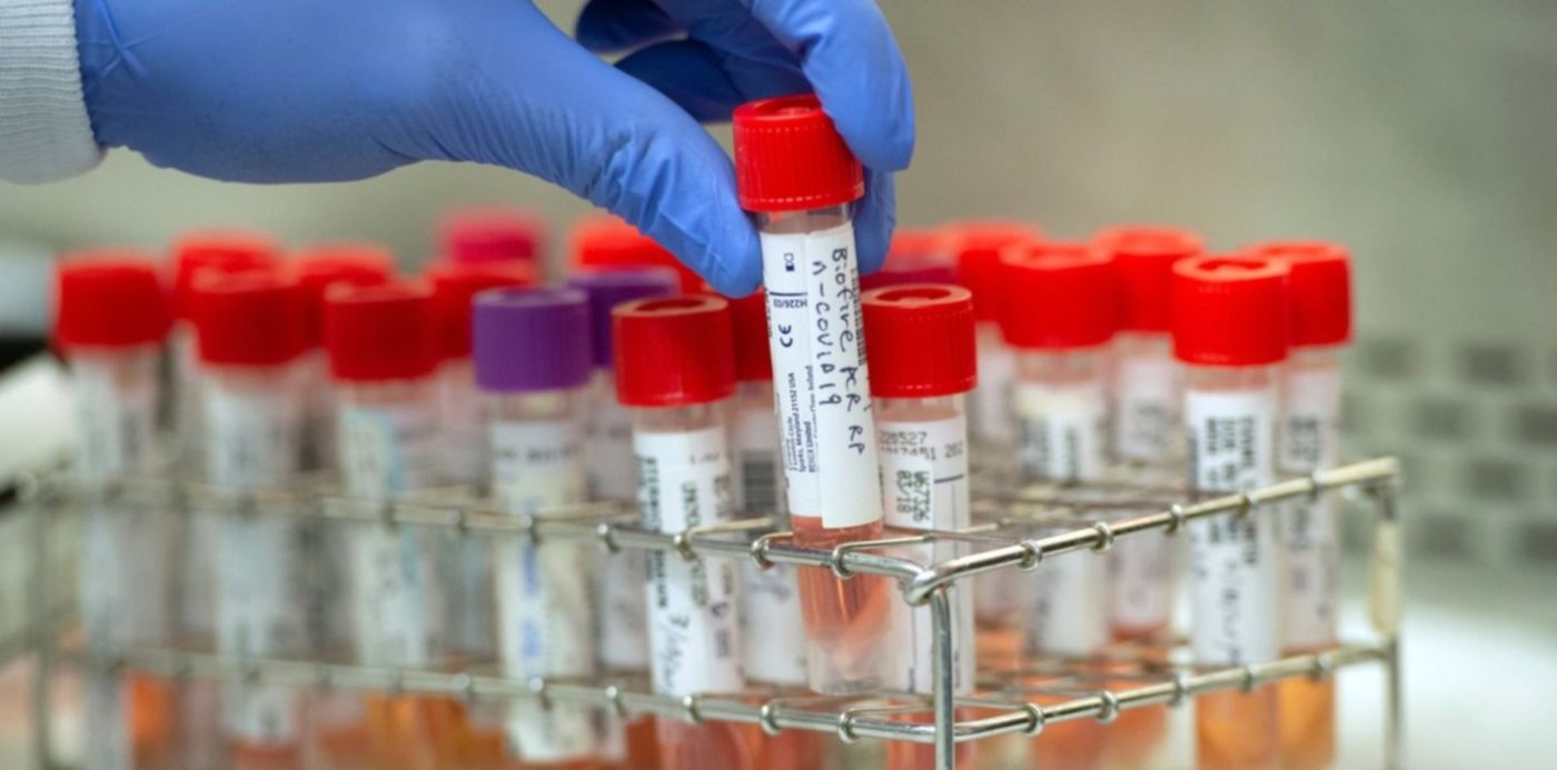 1585424745790.jpeg?x= 5&y=52&width=1503&height=751&rotate=0&scaleX=1&scaleY=1&ow=1500&oh=968&&cw=1920&ch=950