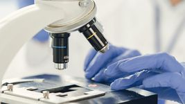 hallan la evidencia mas antigua de una bacteria causante de diversas enfermedades hallan la evidencia mas antigua de una bacteria causante de diversas enfermedades