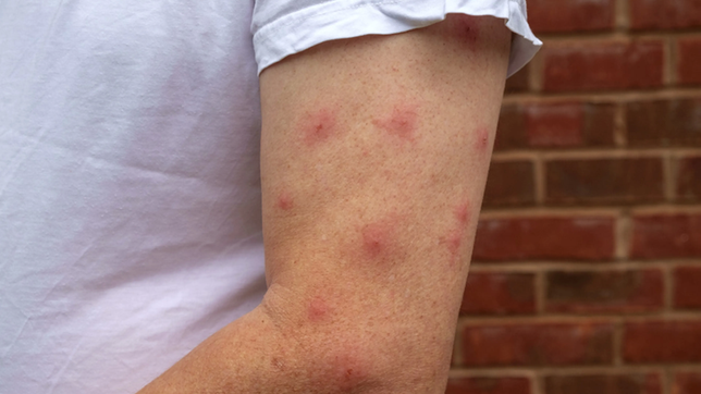 invasion de mosquitos, nula fumigacion del municipio y falta de repelentes en la plata