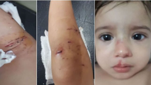 casi la mata, el dramatico relato de la mama de la beba atacada por un pitbull en berisso