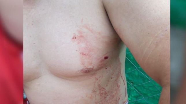 brutal ataque en la plata: intento asesinar a tiros a un vecino en medio de una discusion