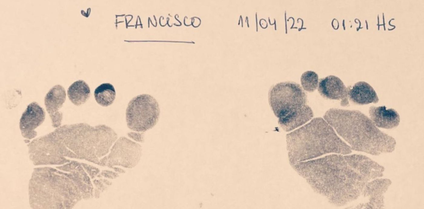 Pies del hijo de Alberto Fernández