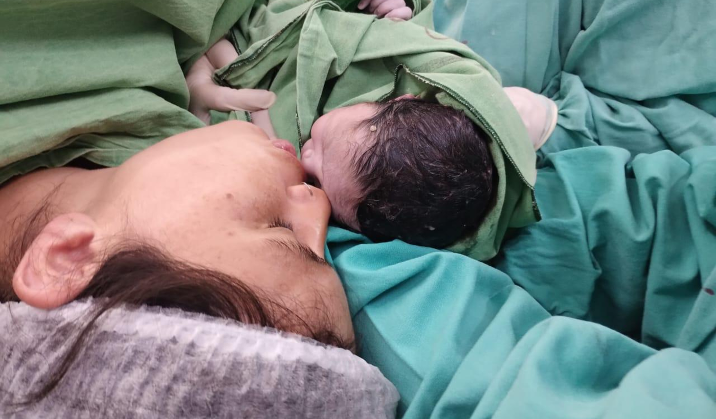 Bebé operado al nacer.png