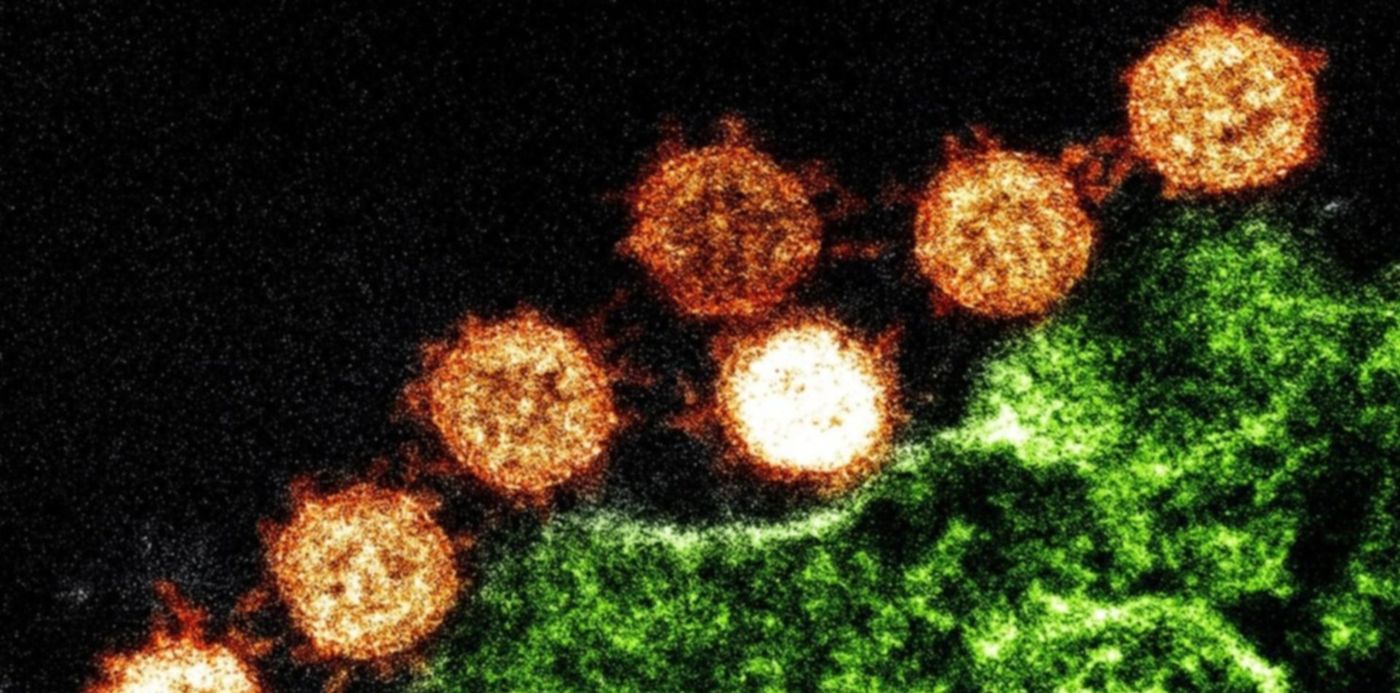 1610642563413.jpg?x=8&y=0&width=1484&height=742&rotate=0&scaleX=1&scaleY=1&ow=1500&oh=742&&cw=1920&ch=950