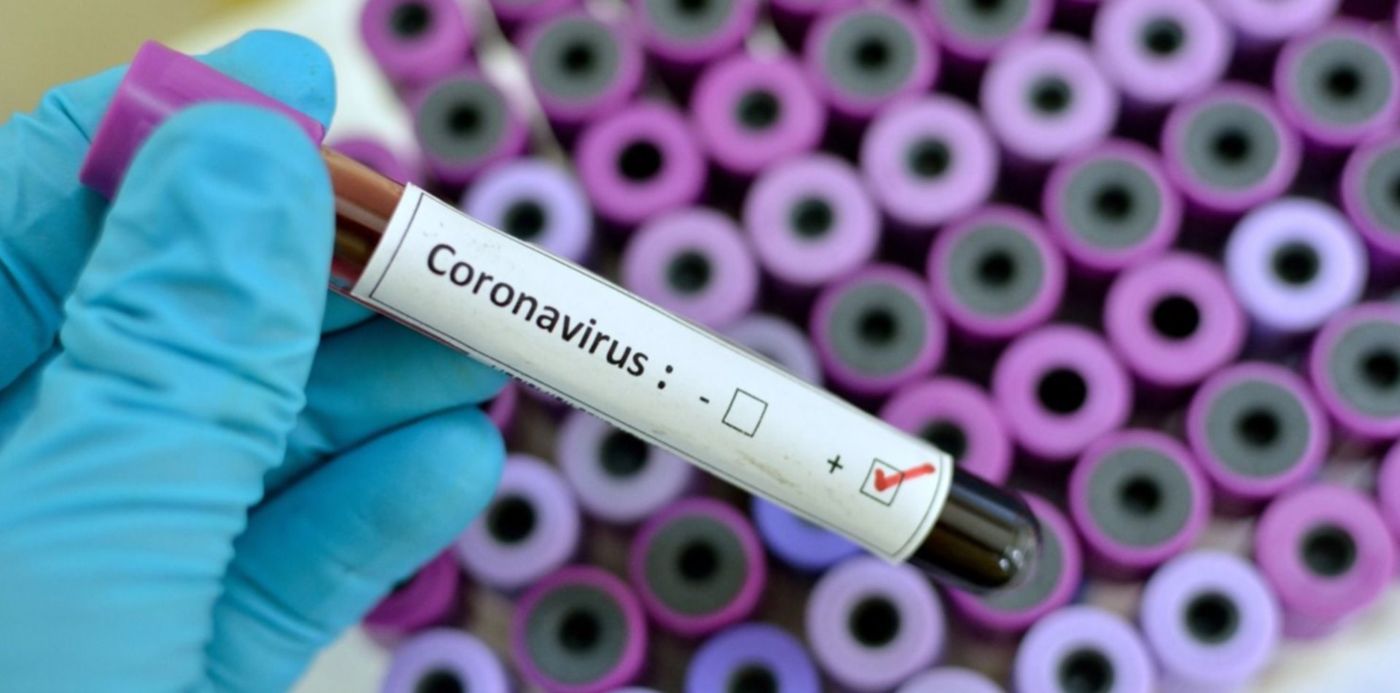 1582779577349.jpg?rotate=0&scaleX=1&ow=1500&width=1485&height=742&scaleY=1&oh=993&x=8&y=147&&cw=1920&ch=950