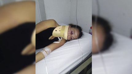 Salió a bailar por su cumpleaños, una boxeadora la golpeó brutalmente y terminó internada