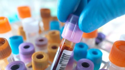 Coronavirus: la provincia de Buenos Aires ya cuenta con 18 centros de testeo