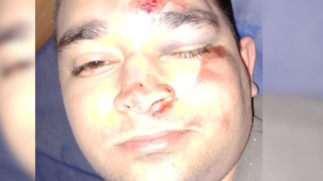 golpearon salvajemente a un joven mientras iba a comprar a una carniceria