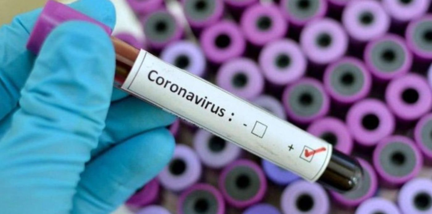 1584972025819.jpg?x=9&y=64&rotate=0&scaleX=1&scaleY=1&ow=1200&width=1184&height=592&oh=680&&cw=1920&ch=950