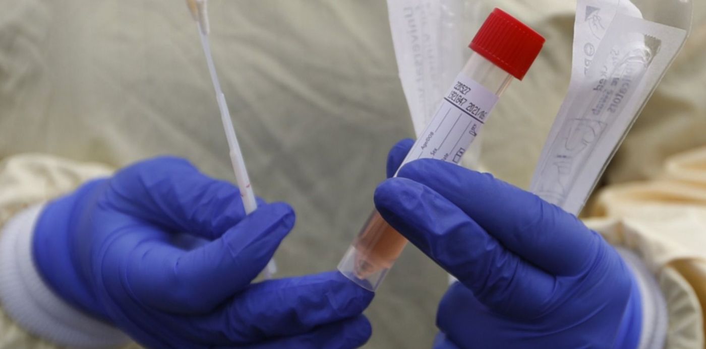 Hisopado Coronavirus casos