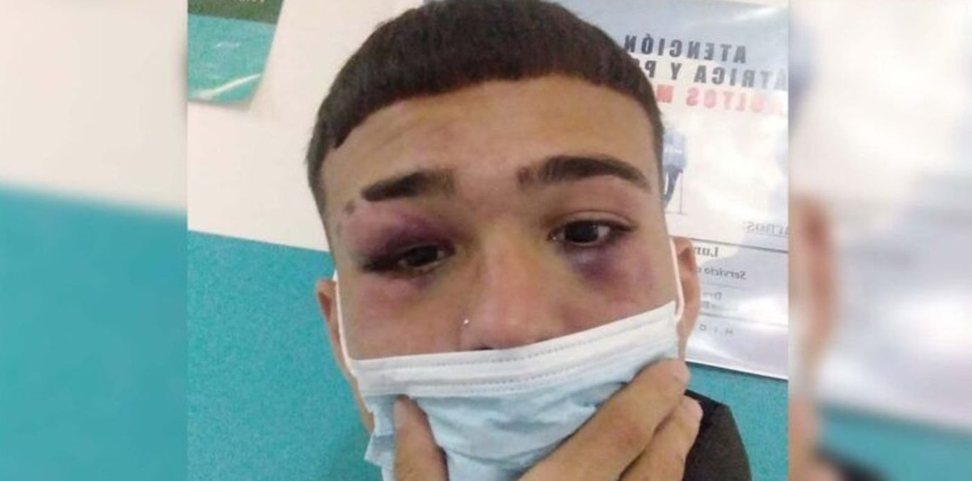 1653235661306.jpg?x=6&y=4&width=785&height=393&rotate=0&scaleX=1&scaleY=1&ow=800&oh=400&&cw=1920&ch=950