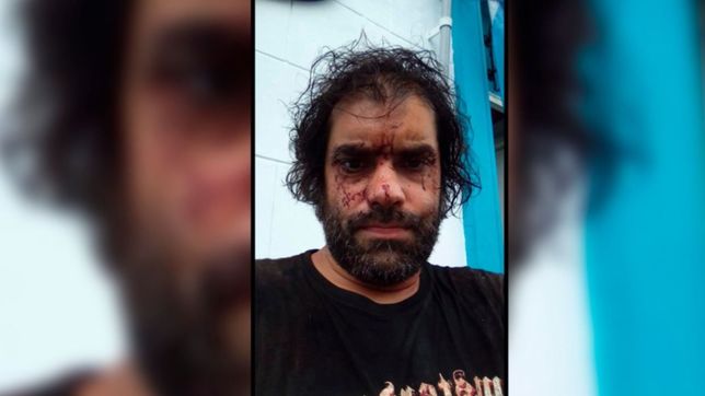 golpearon y le gatillaron a un docente en un violento asalto en la plata